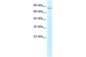 Western Blotting (WB) image for anti-Activating Transcription Factor 6 beta (ATF6B) antibody (ABIN2460387) (ATF6B antibody)