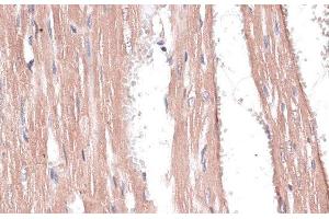 Immunohistochemistry of paraffin-embedded Rat heart using COL11A1 Polyclonal Antibody at dilution of 1:100 (40x lens). (COL11A1 antibody)
