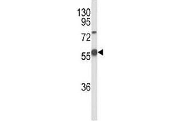 DLL3 antibody  (AA 519-548)