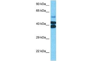 Host:  Rabbit  Target Name:  PTOV1  Sample Type:  Jurkat Whole Cell lysates  Antibody Dilution:  0. (PTOV1 antibody  (N-Term))