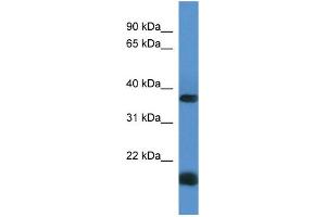 Western Blotting (WB) image for anti-Rhomboid Domain Containing 1 (RHBDD1) (C-Term) antibody (ABIN2788470) (RHBDD1 antibody  (C-Term))