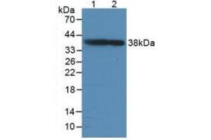 Figure. (GAP43 antibody  (AA 8-226))