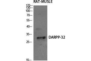 Western Blot (WB) analysis of specific cells using DARPP-32 Polyclonal Antibody. (DARPP32 antibody  (Tyr785))