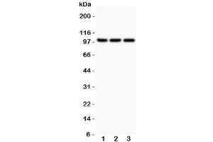 Western blot testing of NFKB2 antibody and Lane 1:  Jurkat;  2: A549;  3: MCF-7;  Expected size: 52 and 100KD, depending on sample tested
