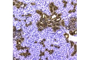 IHC analysis of 14-3-3 zeta/delta using anti-14-3-3 zeta/delta antibody . (14-3-3 zeta antibody)