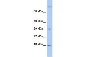 WB Suggested Anti-MGP Antibody Titration:  0. (MGP antibody  (Middle Region))