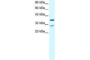 Human brain; WB Suggested Anti-ZNF385 Antibody Titration: 0. (ZNF385A antibody  (N-Term))