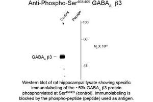 Image no. 1 for anti-gamma-aminobutyric Acid (GABA) A Receptor, beta 2 (GABRB2) (pSer408), (Ser409) antibody (ABIN956760)