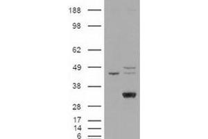 Western blot analysis of LIPG in cell lysates that were transfected with the pCMV6-ENTRY control or pCMV6-ENTRY LIPG cDNA using LIPG polyclonal antibody . (LIPG antibody  (C-Term))