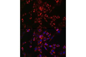 Immunofluorescence analysis of NIH/3T3 cells using HB-EGF Rabbit pAb (ABIN6130449, ABIN6141644, ABIN6141645 and ABIN6218793) at dilution of 1:150 (40x lens). (HBEGF antibody  (AA 20-160))