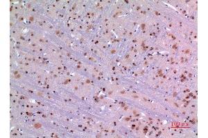 Immunohistochemistry (IHC) image for anti-Mesencephalic Astrocyte-Derived Neurotrophic Factor (MANF) (Internal Region) antibody (ABIN6287177)