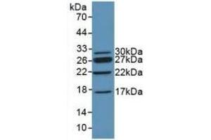 Detection of Recombinant CHD3, Mouse using Polyclonal Antibody to Chromodomain Helicase DNA Binding Protein 3 (CHD3) (CHD3 antibody  (AA 1613-1820))