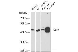 Western blot analysis of extracts of various cell lines using GIPR Polyclonal Antibody at dilution of 1:1000. (GIPR antibody)