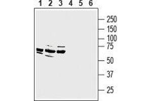 Western blot analysis of rat dorsal root ganglion lysate (lanes 1 and 4), mouse (lanes 2 and 5) and rat (lanes 3 and 6) brain membranes: - 1-3. (MRGPRE antibody  (3rd Intracellular Loop))