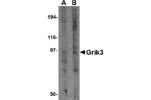Western Blotting (WB) image for anti-Glutamate Receptor, Ionotropic, Kainate 3 (GRIK3) (N-Term) antibody (ABIN1031396) (GRIK3 antibody  (N-Term))