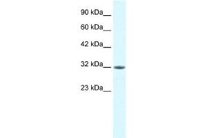 WB Suggested Anti-MORF4L2 Antibody Titration:  0.