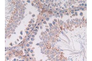 DAB staining on IHC-P; Samples: Rat Intestine Tissue (IL-4 antibody  (AA 61-111))