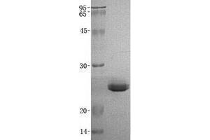 Validation with Western Blot (TREML1 Protein (His tag))