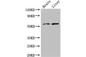 Western Blot Positive WB detected in: Mouse brain tissue, Rat liver tissue All lanes: KCNA1 antibody at 3 μg/mL Secondary Goat polyclonal to rabbit IgG at 1/50000 dilution Predicted band size: 57 kDa Observed band size: 57 kDa (KCNA1 antibody  (AA 7-150))