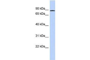 Human PANC1; WB Suggested Anti-ANKZF1 Antibody Titration: 0.