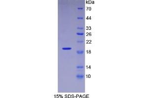 SDS-PAGE (SDS) image for Vascular Endothelial Growth Factor A (VEGFA) ELISA Kit (ABIN6574143)