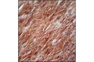 AP17501PU-N IL2 Antibody staining of Formalin Fixed, Paraffin Embedded Mouse heart tissue followed by peroxidase conjugation of the secondary antibody and DAB staining.