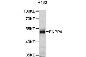 Western blot analysis of extracts of H460 cells, using ENPP4 antibody (ABIN5972569) at 1:3000 dilution. (ENPP4 antibody)