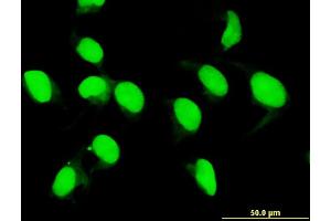 Immunofluorescence of monoclonal antibody to MLKL on HeLa cell.