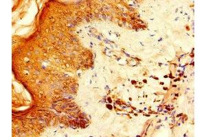 Immunohistochemistry of paraffin-embedded human skin tissue using ABIN7142567 at dilution of 1:100 (RPS6 antibody  (AA 35-229))