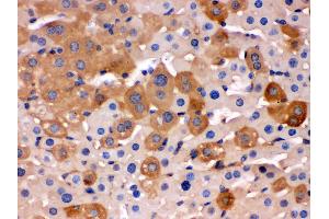 Immunohistochemistry (Paraffin-embedded Sections) (IHC (p)) image for anti-Transferrin (TF) (AA 20-49), (N-Term) antibody (ABIN3043419) (Transferrin antibody  (N-Term))