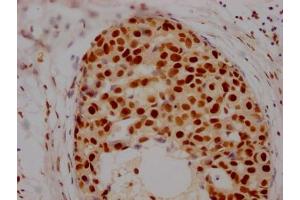 Immunohistochemistry (IHC) image for anti-Histone Deacetylase 2 (HDAC2) antibody (ABIN7127538)