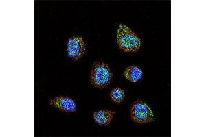 Immunofluorescence (IF) image for anti-Hypoxia Inducible Factor 1, alpha Subunit (Basic Helix-Loop-Helix Transcription Factor) (HIF1A) (AA 728-757) antibody (ABIN3031282)