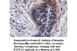 Image no. 1 for anti-Protein Tyrosine Phosphatase G1 (PTPN12) antibody (ABIN791170) (PTPN12 antibody)