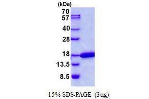 Figure annotation denotes ug of protein loaded and % gel used. (CDK2AP2 Protein)