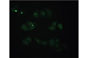 Staining of methanol-fixed Hela cells by Immunocytochemistry using Mouse anti-Human beta 2 Microglobulin monoclonal antibody (D2E9) at 1/50 (20 µg/ml). (beta-2 Microglobulin antibody)