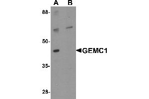 Western blot analysis of GEMC1 in mouse heart tissue lysate with GEMC1 antibody at 1 µg/mL in (A) the absence and (B) the presence of blocking peptide (GEMC1 antibody  (Middle Region))