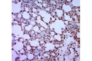 Paraformaldehyde-fixed, paraffin embedded rat lung; Antigen retrieval by boiling in sodium citrate buffer (pH6.