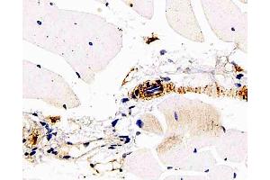 Immunohistochemistry analysis of paraffin-embedded mouse skeletal muscle using DLL4 Polyclonal Antibody at dilution of 1:200. (DLL4 antibody)