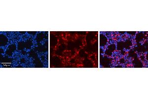 Rabbit Anti-ATF4 Antibody   Formalin Fixed Paraffin Embedded Tissue: Human Bone Marrow Tissue Observed Staining: Cytoplasm, Nucleus Primary Antibody Concentration: 1:600 Other Working Concentrations: N/A Secondary Antibody: Donkey anti-Rabbit-Cy3 Secondary Antibody Concentration: 1:200 Magnification: 20X Exposure Time: 0.