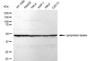 anti-Lipoprotein Lipase (LPL) antibody