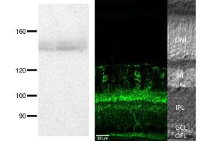 Adult rat retina membrane immunoblot (left) and immunofluorescence (right).