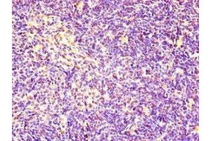 Immunohistochemistry of paraffin-embedded human thymus tissue using ABIN7167020 at dilution of 1:100 (RACGAP1 antibody  (AA 86-331))