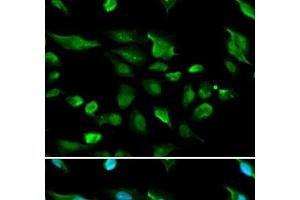 Immunofluorescence analysis of A549 cells using AIRE Polyclonal Antibody (AIRE antibody)