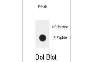 Dot Blot (DB) image for anti-Plexin D1 (PLXND1) (pTyr1642) antibody (ABIN3001877) (PLXND1 antibody  (pTyr1642))