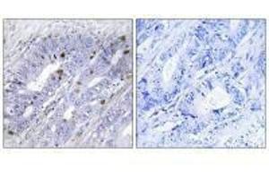 Immunohistochemistry (IHC) image for anti-Nuclear Receptor Subfamily 4, Group A, Member 1 (NR4A1) (Ser351) antibody (ABIN7180055)