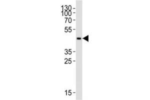 Western blot analysis of lysate from THP-1 cell line using CCR2 antibody at 1:1000. (CCR2 antibody  (AA 336-369))