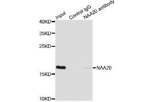 Immunoprecipitation analysis of 200 μg extracts of MCF7 cells using 1 μg NAA20 antibody (ABIN5974272). (NAT5 antibody)