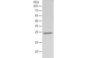 Western Blotting (WB) image for Vimentin (VIM) (AA 2-201) protein (His tag) (ABIN7282984) (Vimentin Protein (VIM) (AA 2-201) (His tag))