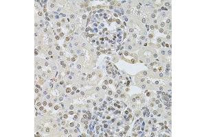 Immunohistochemistry of paraffin-embedded rat kidney using DR1 Antibody (ABIN2562286) at dilution of 1:100 (40x lens). (DR1 antibody)