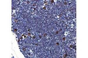 IHC analysis of Il2ra using anti-Il2ra antibody (ABIN7600684). (CD25 antibody  (AA 22-268))